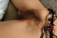 ATK hairy  in mature and hairy