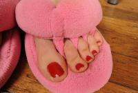 ATK hairy  in mature and hairy