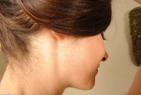 ATK hairy  in mature and hairy