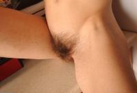 ATK hairy  in mature and hairy