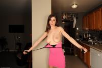 ATK hairy  in mature and hairy