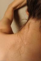 ATK hairy  in mature and hairy