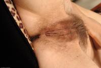 ATK hairy  in mature and hairy