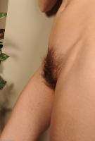 ATK hairy  in mature and hairy