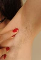 ATK hairy  in mature and hairy
