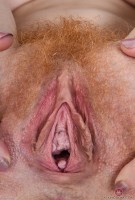 ATK hairy  in young and hairy