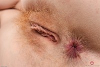 ATK hairy  in young and hairy