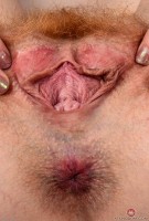 ATK hairy  in young and hairy