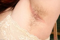 ATK hairy  in mature and hairy