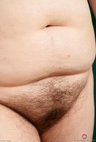 ATK hairy  in mature and hairy