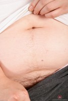 ATK hairy  in mature and hairy