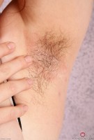 ATK hairy  in mature and hairy