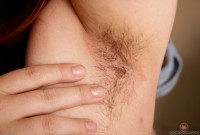 ATK hairy  in mature and hairy