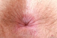 ATK hairy  in young and hairy