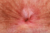 ATK hairy Adora Bell Set