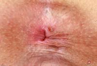 ATK hairy Aften Opal Set