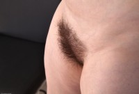 ATK hairy  in mature and hairy