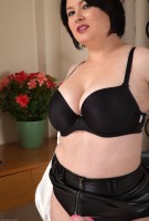 ATK hairy  in mature and hairy