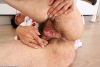ATK hairy  in mature and hairy