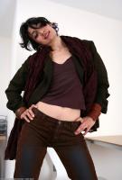 ATK hairy  in mature and hairy