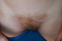ATK hairy Vaselisa Set