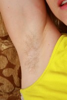 ATK hairy  in young and hairy