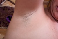 ATK hairy  in mature and hairy