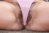 ATK hairy  in mature and hairy