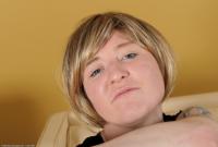 ATK hairy  in mature and hairy