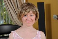 ATK hairy  in mature and hairy