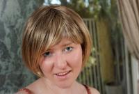 ATK hairy  in mature and hairy