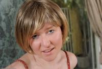 ATK hairy  in mature and hairy