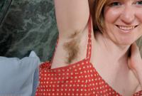 ATK hairy  in mature and hairy