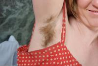 ATK hairy  in mature and hairy