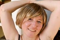 ATK hairy  in mature and hairy