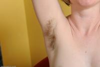 ATK hairy  in mature and hairy