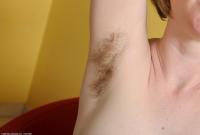 ATK hairy  in mature and hairy