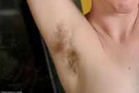 ATK hairy  in mature and hairy