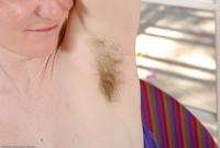 ATK hairy  in mature and hairy