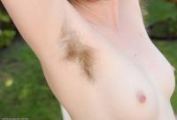 ATK hairy  in mature and hairy