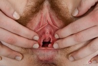 ATK hairy  in young and hairy