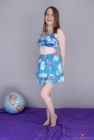 ATK hairy  in young and hairy