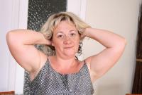 ATK hairy  in mature and hairy