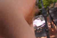 ATK hairy  in pregnant