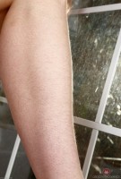 ATK hairy  in young and hairy