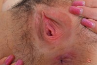 ATK hairy  in young and hairy