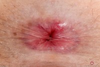 ATK hairy  in exotic and hairy