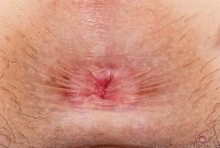 ATK hairy Amber Faye Set