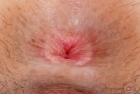 ATK hairy Amber Faye Set