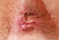 ATK hairy Amber Summer Set